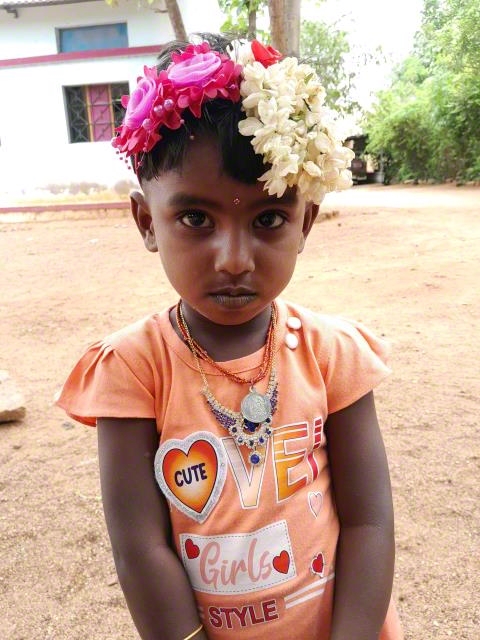 World Vision India